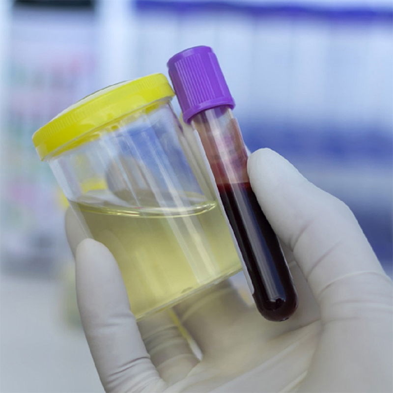 Kiểm tra Doping là gì và nó ảnh hưởng đến sự nghiệp của vận động viên như thế nào?